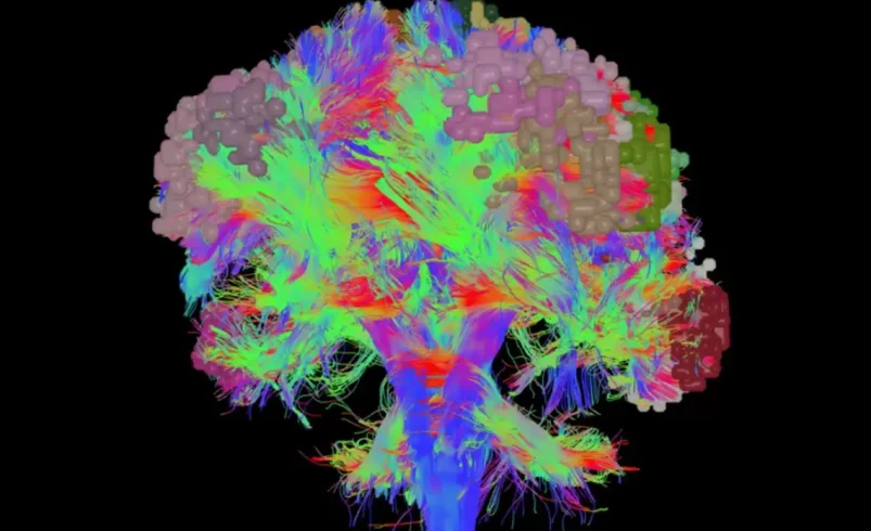 FDA Antoi Myyntiluvan: Aivojen Kartoitus Nopeutuu AI-Softalla